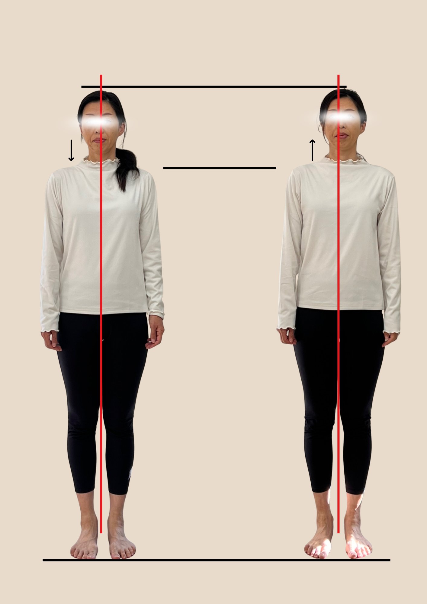 Before/After